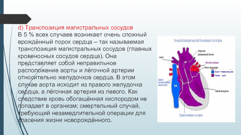 Транспозиция магистральных артерий презентация