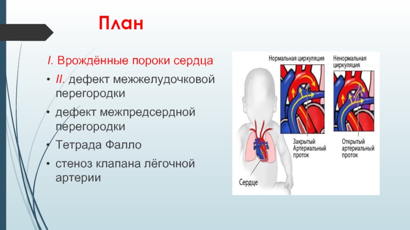 Клапан легочной артерии норма