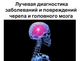 Лучевая диагностика заболеваний и повреждений черепа и головного мозга