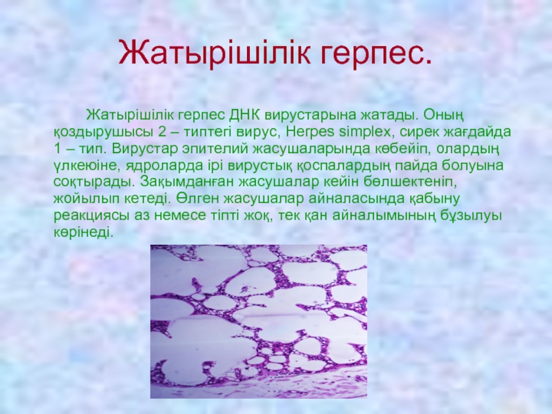 Днк herpes simplex