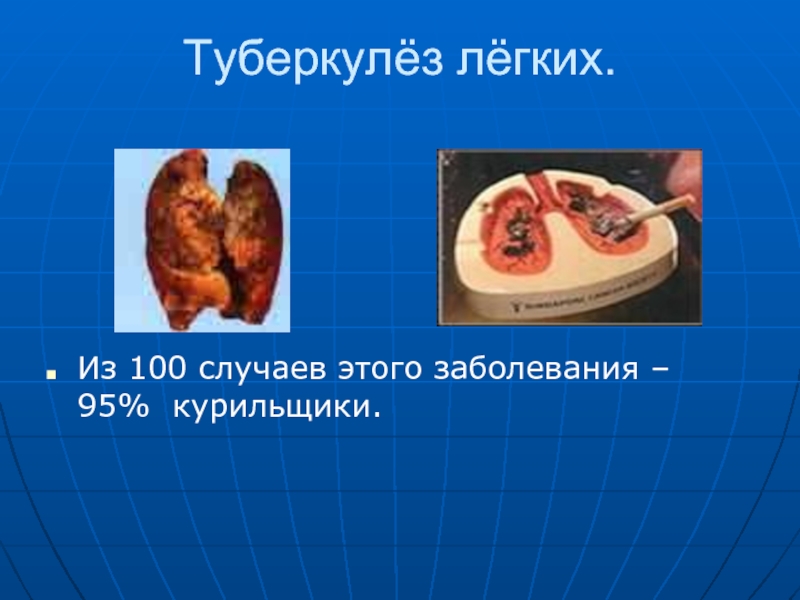 100 случаев