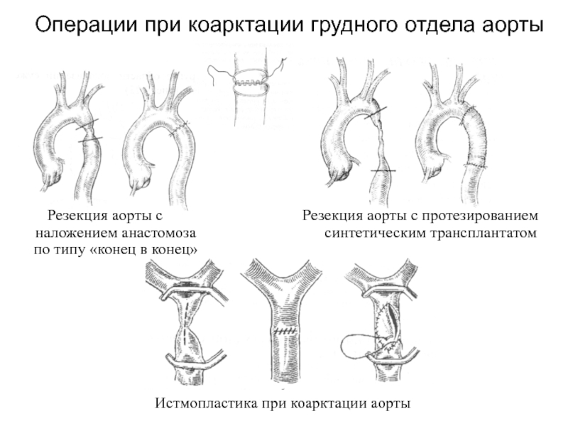 Лоскуты на микрососудистом анастомозе применяемые в челюстно лицевой хирургии презентация