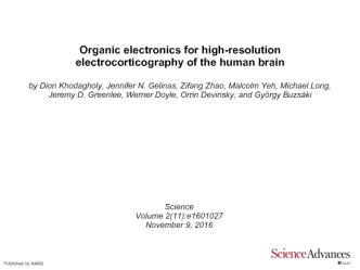 Organic electronics for high-resolution electrocorticography of the human brain