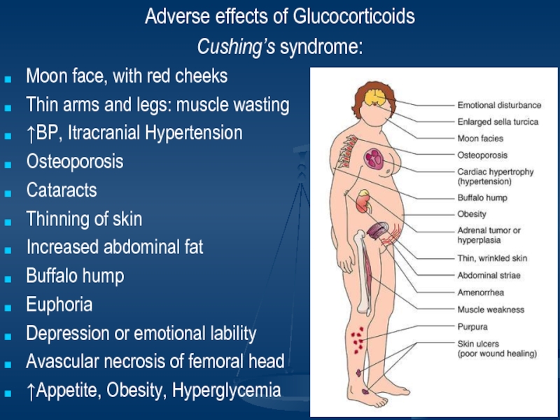 Adverse effects of GlucocorticoidsCushing’s syndrome: Moon face, with red c...