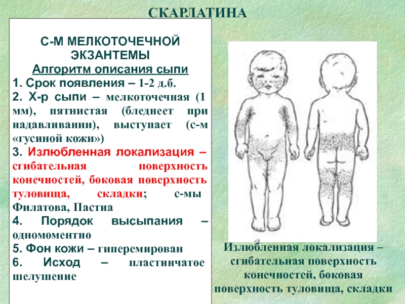 Перевод изображения мелкоточечная