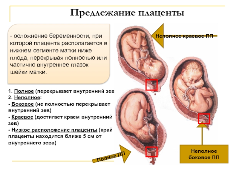 Плацента внутренний зев