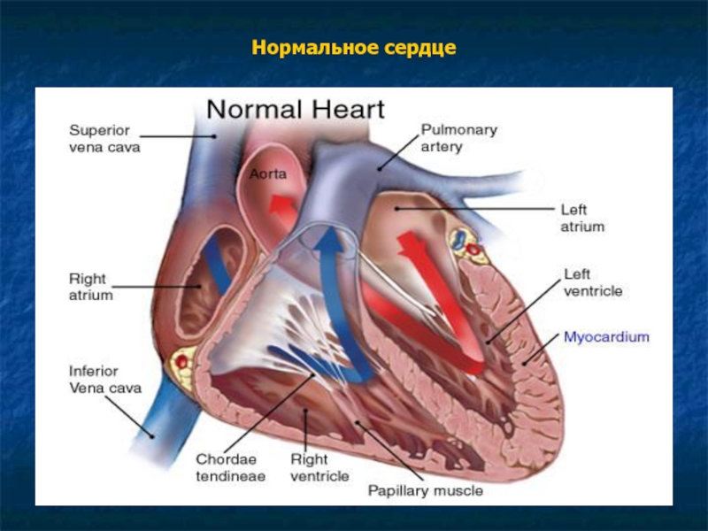 Нормальный сердечный. Сердечный отек презентация. Нормальное сердце ребенка. Отек в полости сердца называется.