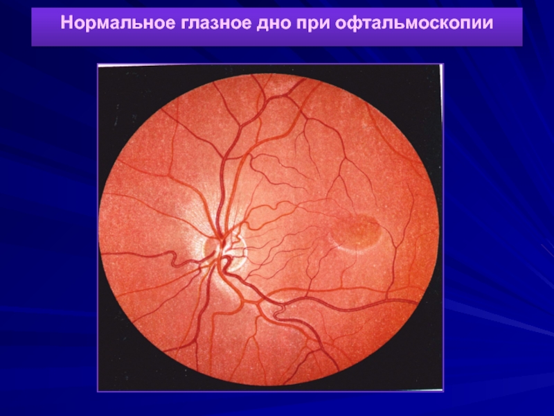 Нормальная офтальмоскопическая картина
