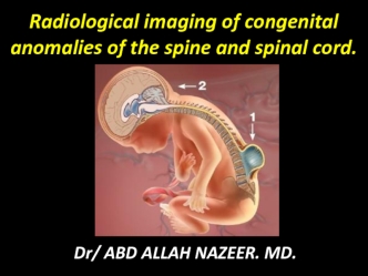 Radiological imaging of congenital anomalies of the spine and spinal cord.