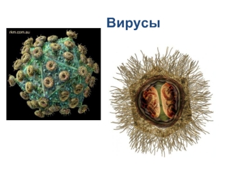 Вирусы. Размеры вирусов. Строение вирусов