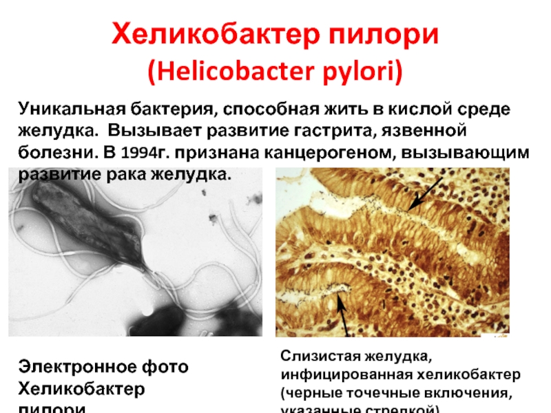 Helicobacter pylori estado de animo