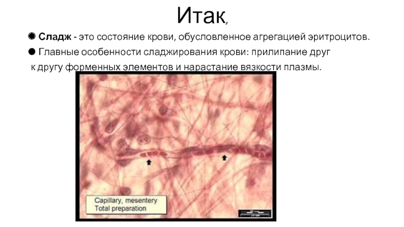 Сладж синдром рисунок