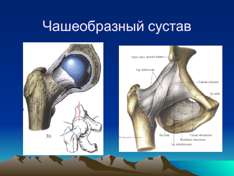 Травматические вывихи бедра презентация