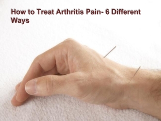 How to Treat Arthritis Pain- 6 Different Ways
