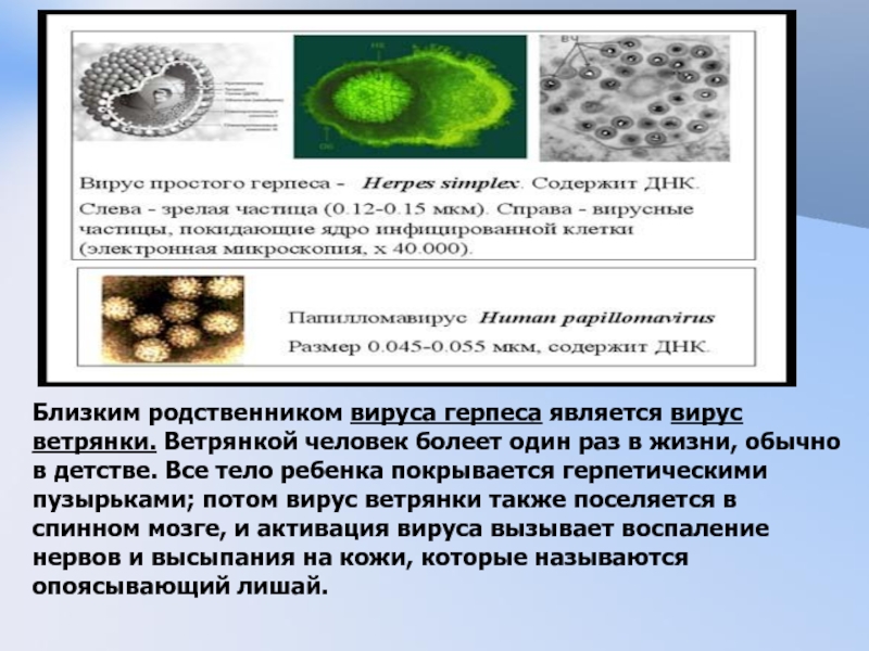 Вирус герпеса презентация. Вирус герпеса электронная микроскопия. Вирус герпеса размер. Вирус ветрянки и вирус герпеса.