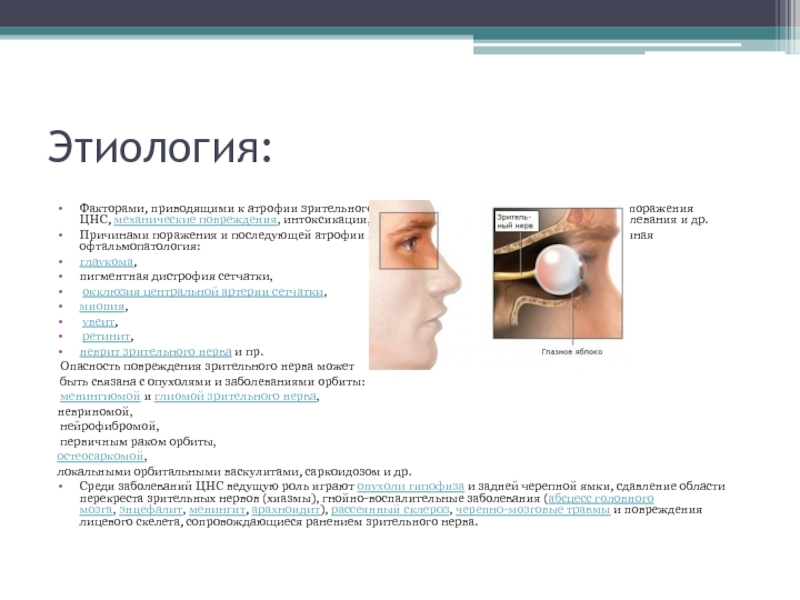 Офтальмология. Атрофия зрительного нерва