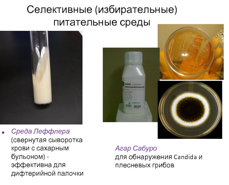 Посев крови на сахарный бульон