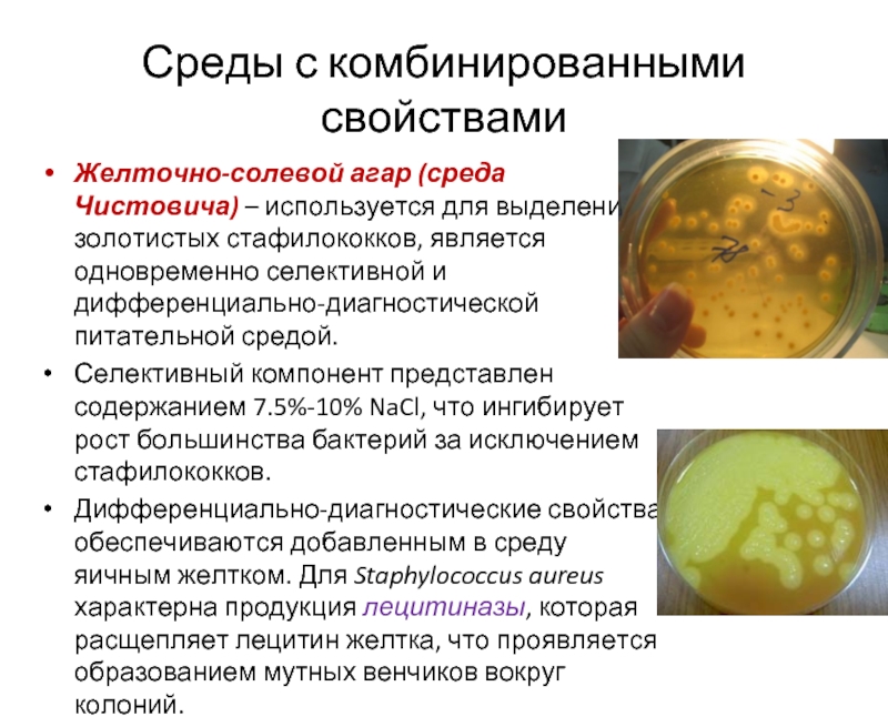 Staphylococcus aureus среда. Питательная среда желточно солевой агар. Культивирование золотистого стафилококка. Селективные питательные среды для стафилококков. Укажите селективные питательные среды для стафилококков:.