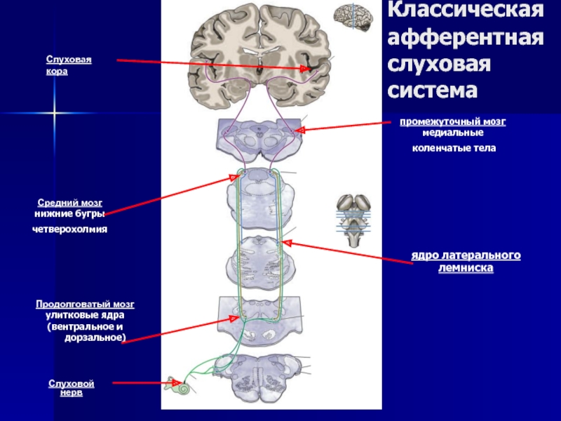 Коленчатые тела мозга. Слуховые ядра продолговатого мозга. Ядро латерального лемниска. Дорсальное и вентральные ядра слухового анализатора. Коленчатые тела промежуточного мозга.