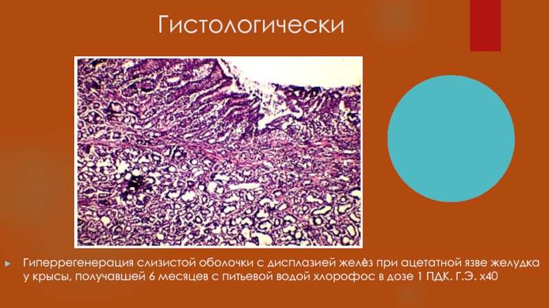 Регенерации слизистой оболочки. Гиперрегенерация слизистой оболочки. Физиологическая регенерация слизистой оболочки желудка. Гипорегенерация и гиперрегенерация.
