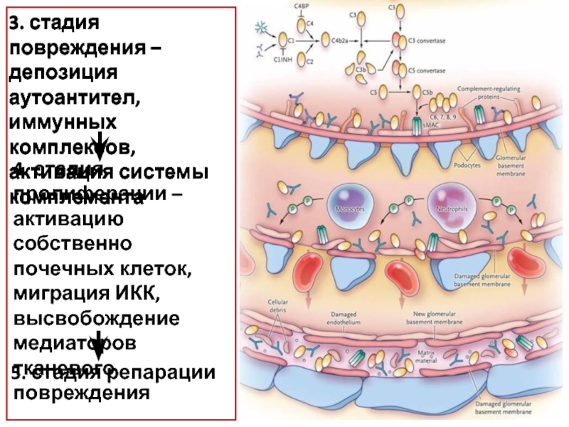 3 степень ранения. Плакат иммунные комплексы. Депозиыия.