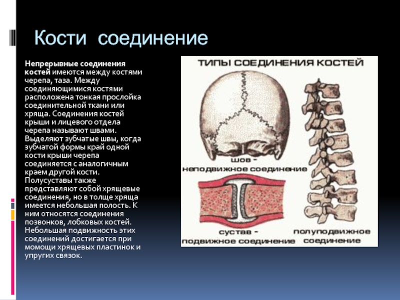 Непрерывные кости. Соединение костей туловища и черепа. Непрерывные соединения черепа таблица. Соединение костей черепа швы. Типы соединений между костями.