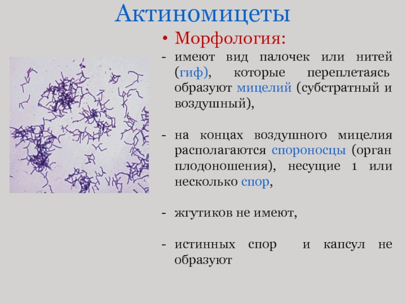 Имеет разновидности. Актиномицеты микробиология морфология. Актиномицеты микробиология форма. Строение актиномицетов микробиология. Морфология бактерий актиномицетов.