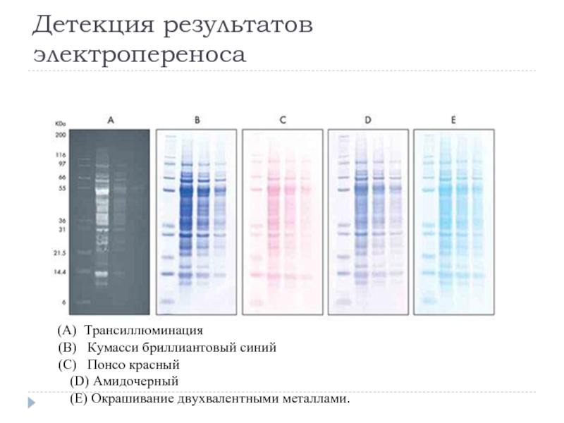 Детекция что это. Детекция результатов это. Электрофоретическое окрашивание. Кумасси окраска белков. Электрофоретические маркеры.