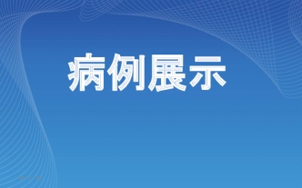 病例展示