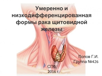 Умеренно и низкодифференцированная формы рака щитовидной железы