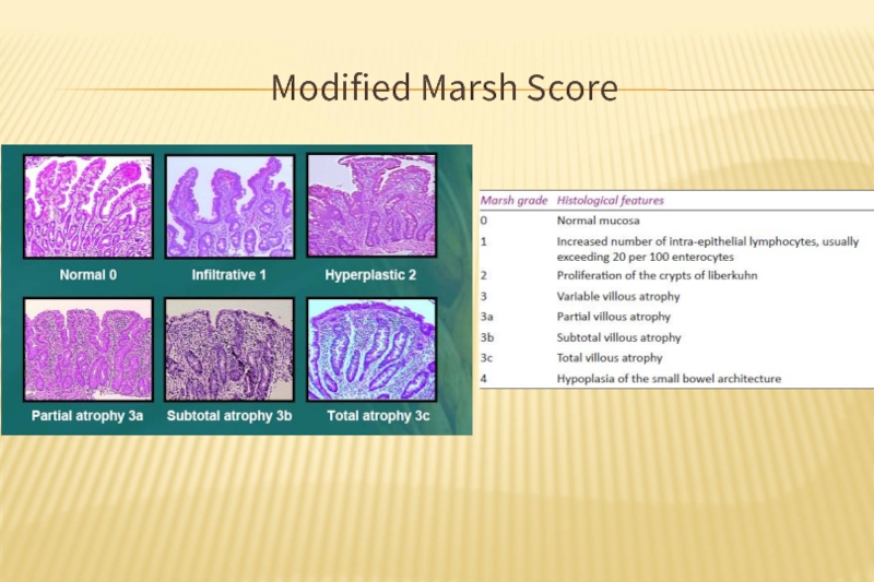 Modified Marsh Score. 
