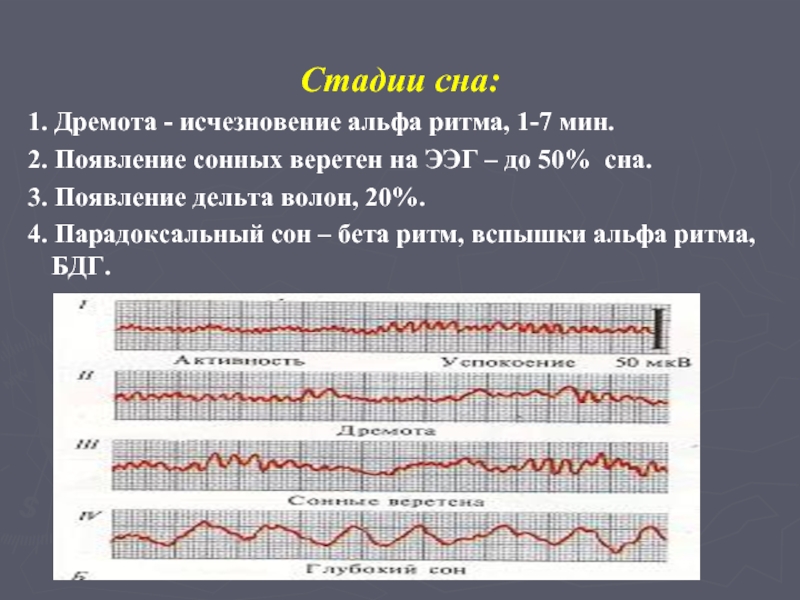 Нарисовать схему стадий сна по данным ээг