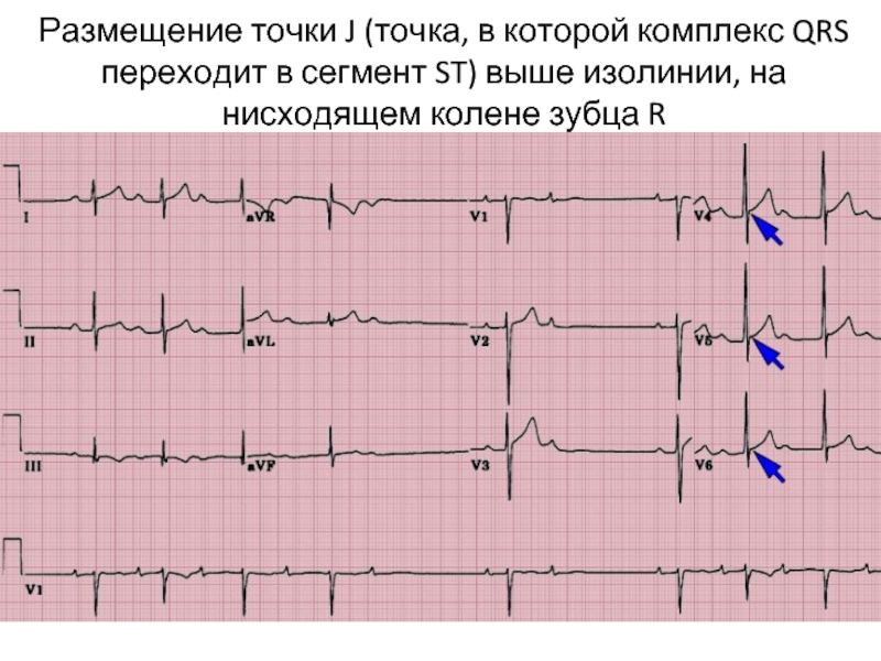 St на изолинии