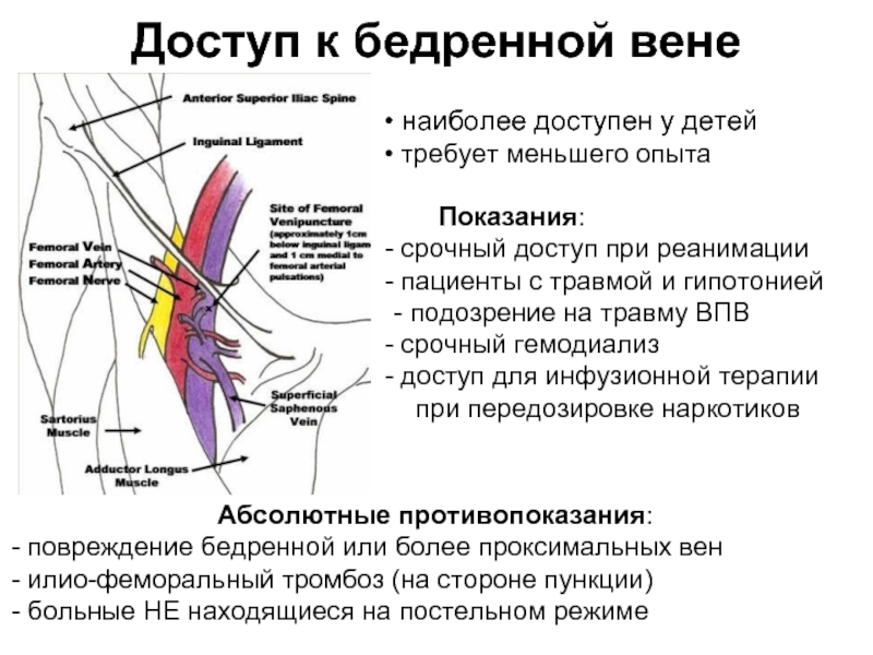 Где паховая вена у мужчин