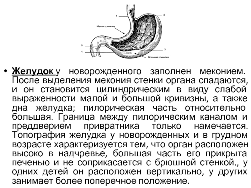 Кривизна желудка. Желудок новорожденных. Строение желудка младенца. Каскадная форма желудка. Каскадная деформация желудка.