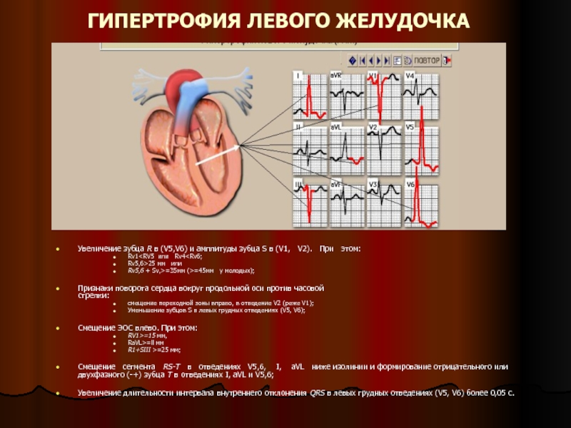 Поворот сердца