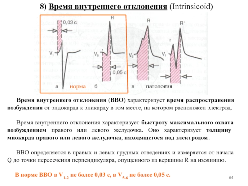 Отклонения на экг. Внутреннее отклонение на ЭКГ. Время внутреннего отклонения на ЭКГ норма. Интервал внутреннего отклонения QRS. Увеличение времени внутреннего отклонения на ЭКГ.