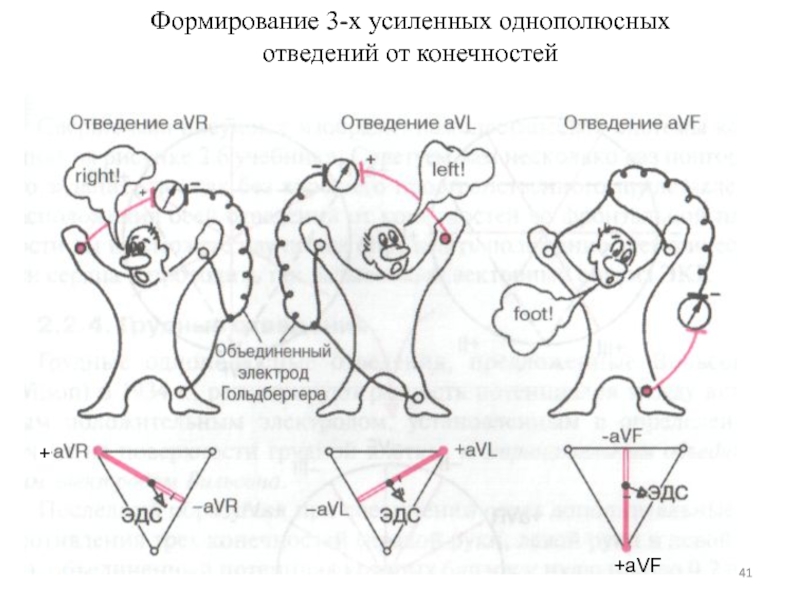 Усиленные отведения экг схема