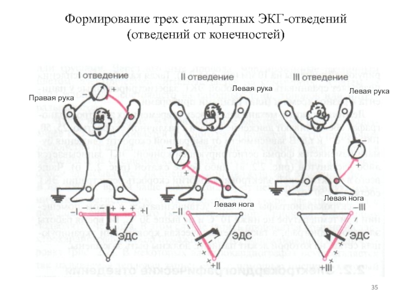 Картинка стандартные отведения