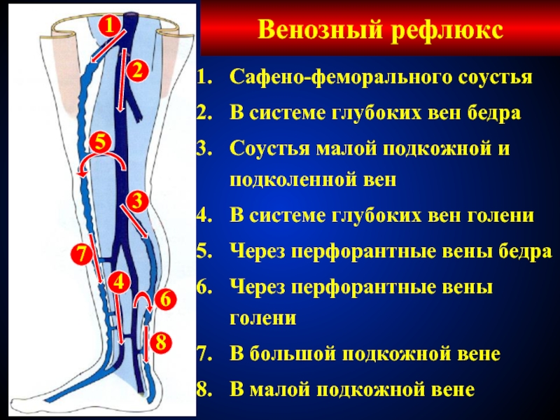 Рефлюкс нижних конечностей. Перфорантные вены нижних конечностей анатомия. Перфорантные вены голени анатомия. Перфорантная Вена в средней трети голени это. Перфоранты вен нижних конечностей.