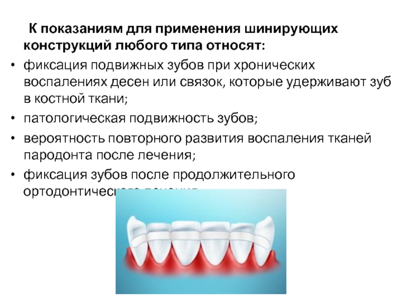 Подвижность зубов презентация