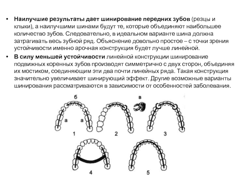 Временное шинирование