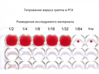 Титрование вируса гриппа в РГА