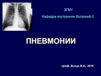 Пневмония. Определение точной этиологии пневмоний