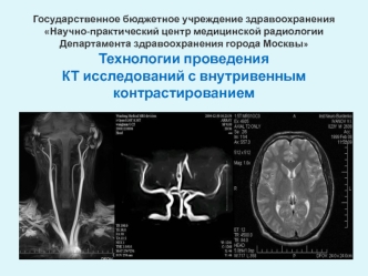 Технологии проведения КТ исследований с внутривенным контрастированием