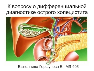 Дифференциальная диагностика острого холецистита