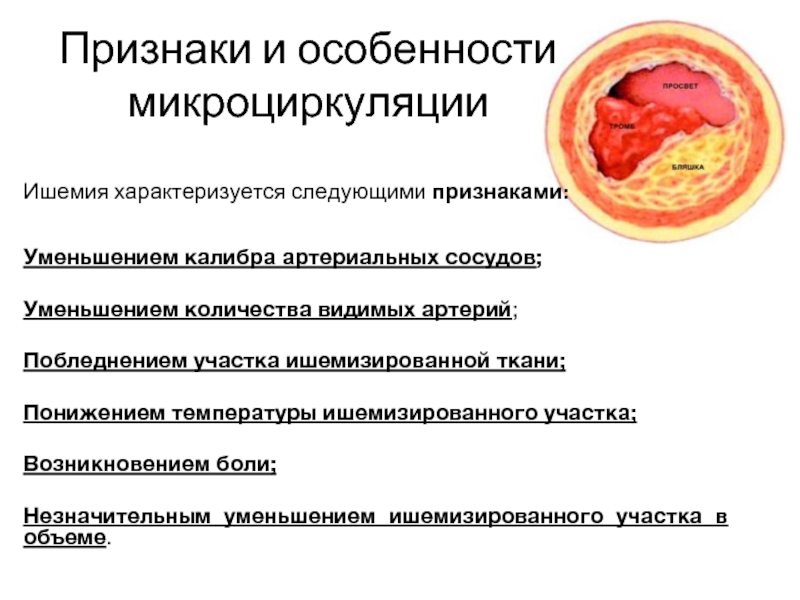 Острая артериальная ишемия презентация