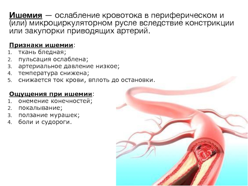 Хронические заболевания артерий