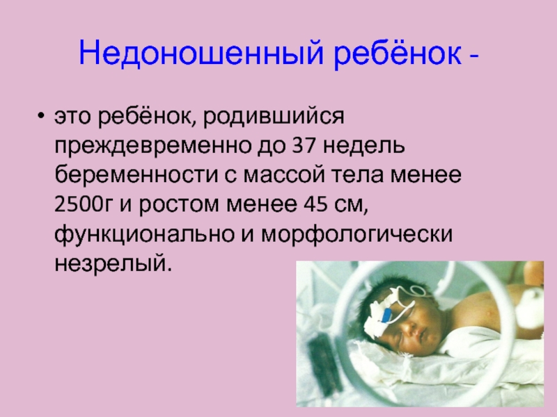 Сколько недоношенный ребенок. Недоношенный незрелый ребенок. Причины рождения недоношенного ребенка. 37 Недель это доношенная беременность.