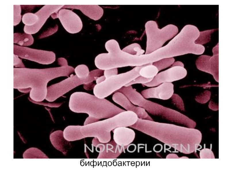 Бифидобактерии. Bifidobacterium bifidum микробиология. Bifidobacterium adolescentis. Бифидобактерии для кишечника. Пропионовокислые бактерии и бифидобактерии.